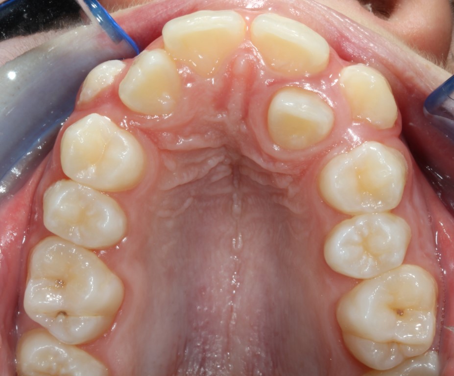 Dentista a Cagliari e Iglesias: ortodonzia e altre specialità, scopri la SORRISI & SOGNI EXPERIENCE