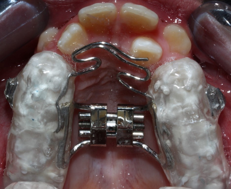 Dentista a Cagliari e Iglesias: ortodonzia e altre specialità, scopri la SORRISI & SOGNI EXPERIENCE