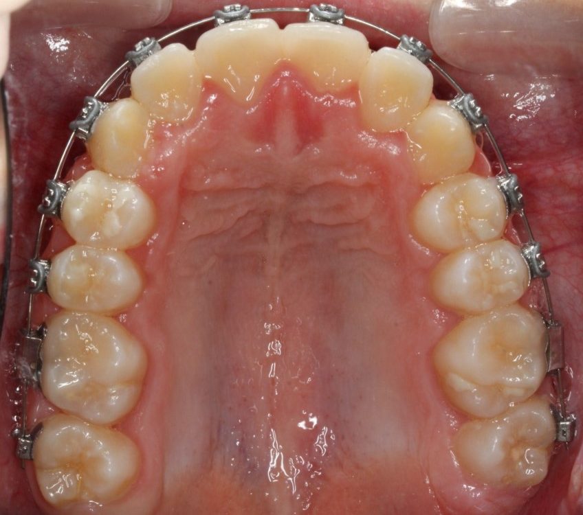 Dentista a Cagliari e Iglesias: ortodonzia e altre specialità, scopri la SORRISI & SOGNI EXPERIENCE