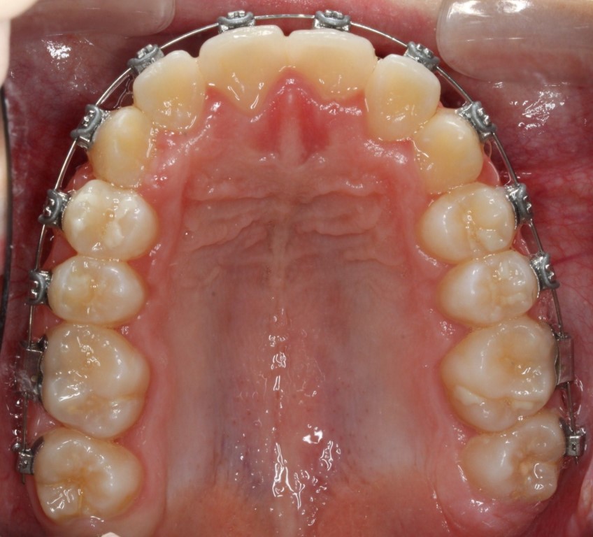 Dentista a Cagliari e Iglesias: ortodonzia e altre specialità, scopri la SORRISI & SOGNI EXPERIENCE