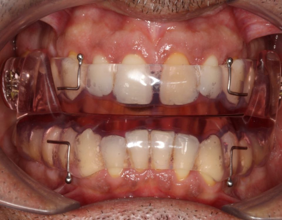 Dentista a Cagliari e Iglesias: ortodonzia e altre specialità, scopri la SORRISI & SOGNI EXPERIENCE