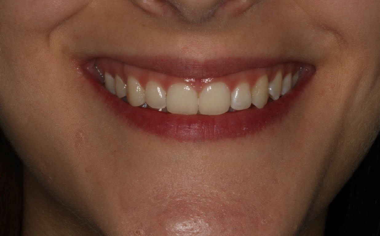Dentista a Cagliari e Iglesias: ortodonzia e altre specialità, scopri la SORRISI & SOGNI EXPERIENCE