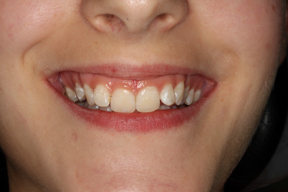 Dentista a Cagliari e Iglesias: ortodonzia e altre specialità, scopri la SORRISI & SOGNI EXPERIENCE